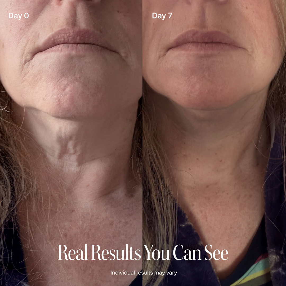 PINK NECK FIRMING CREAM
