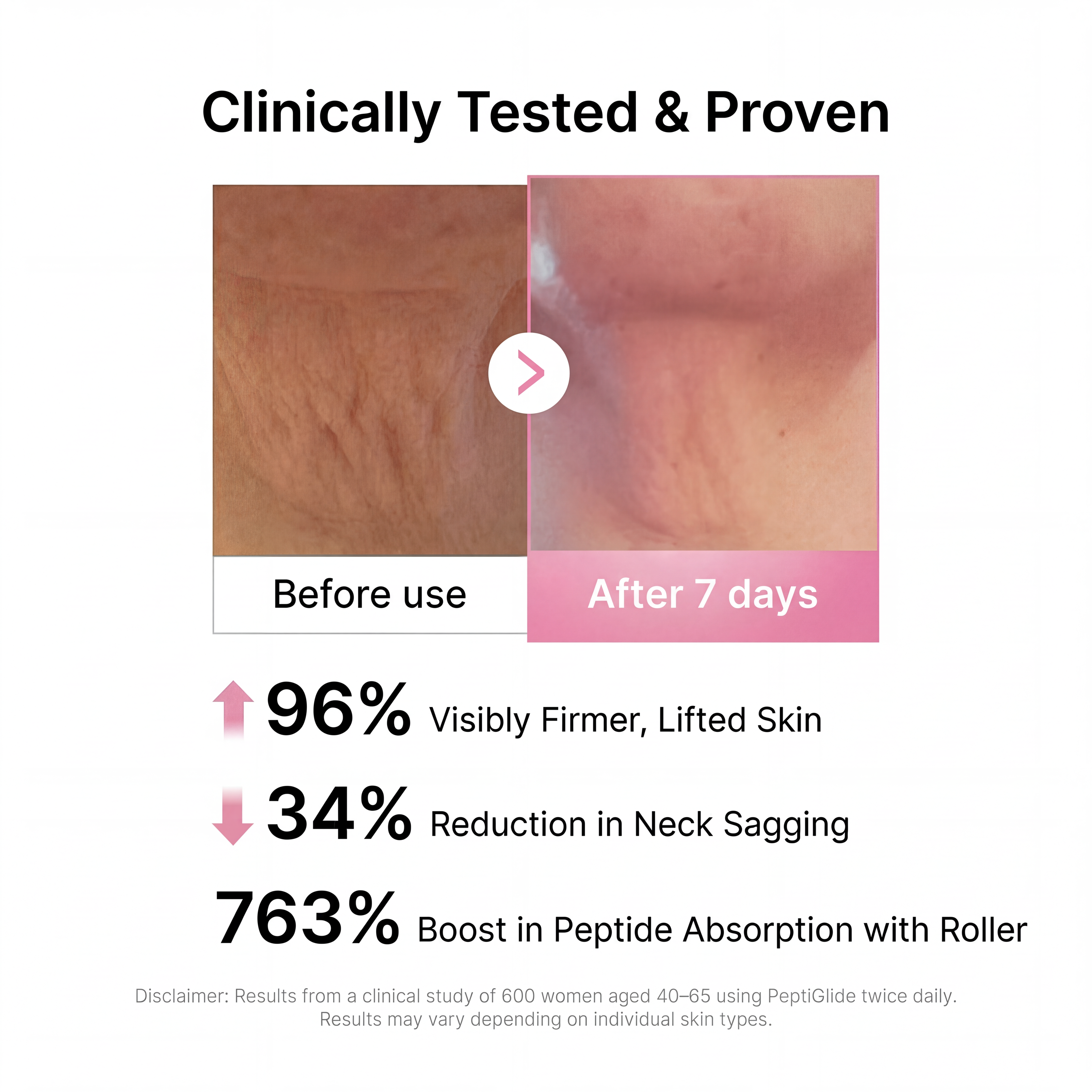 PINK NECK FIRMING CREAM